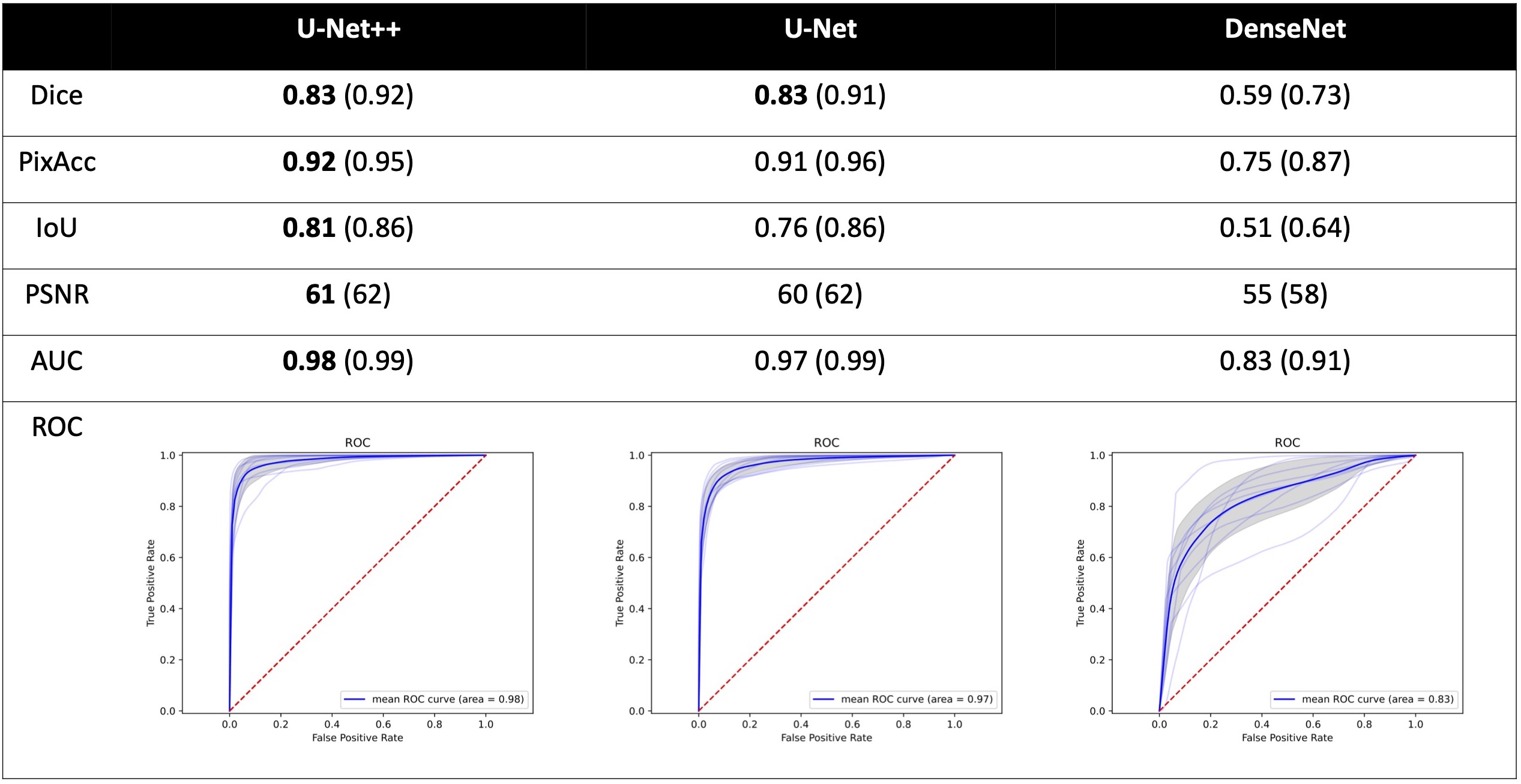 summary of results between U-Net, U-Net++, and DenseNet for different scoring metrics for testing and validation